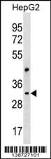 CEP170P1 Antibody (RB38727)