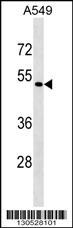 EIF2S3B Antibody (RB30528)