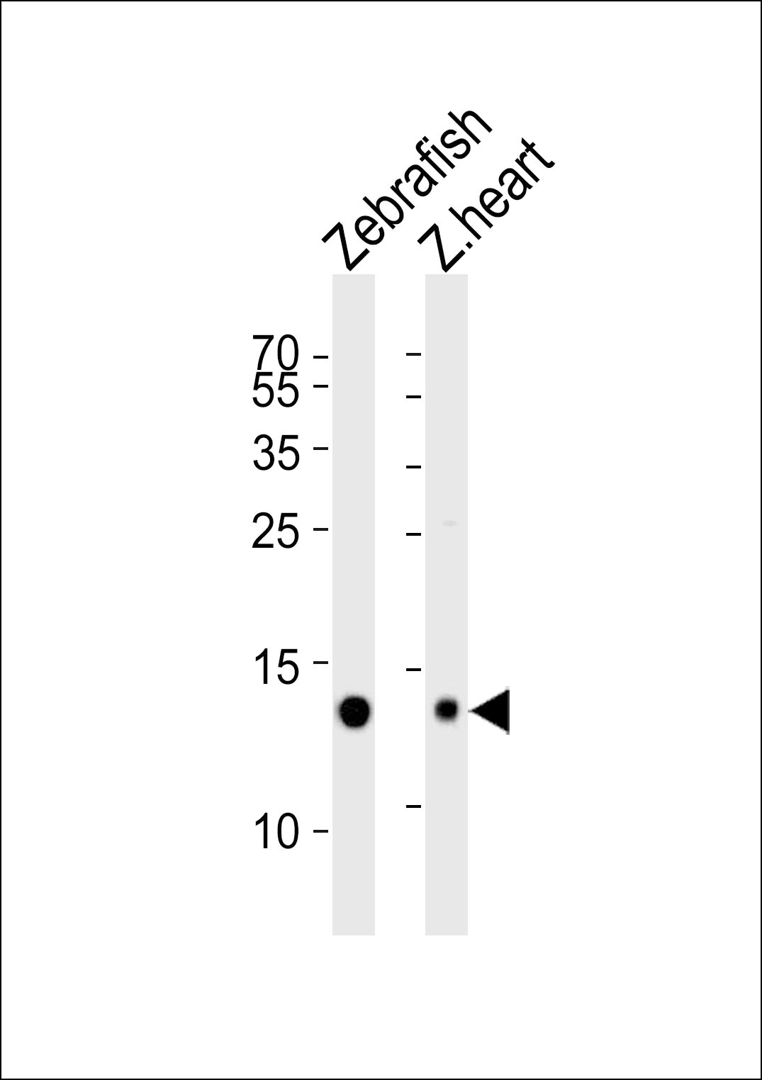 fabp10a Antibody (RB46524)