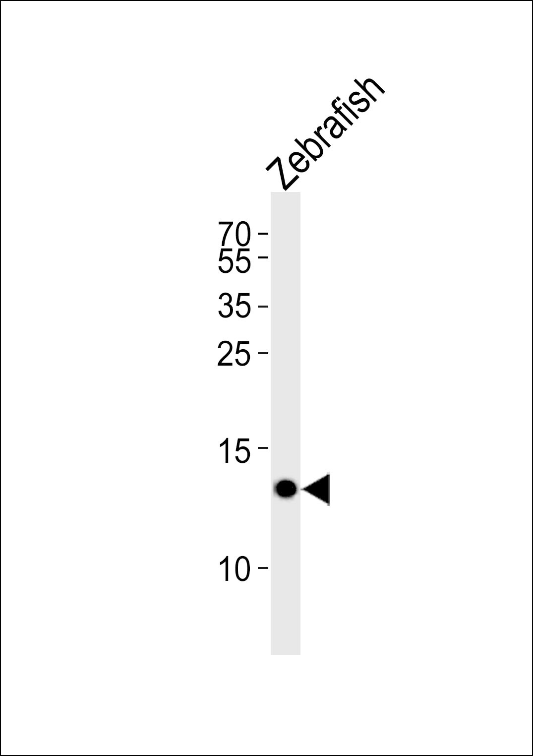 fabp10a Antibody (RB46567)