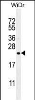 FAM237A/NPGL Antibody (RB29706)
