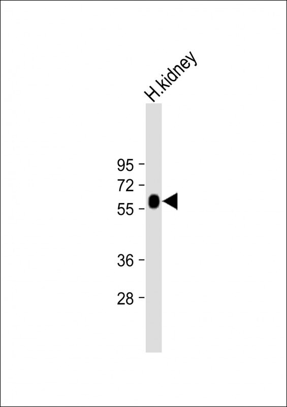 GGT3P Antibody (RB55245)