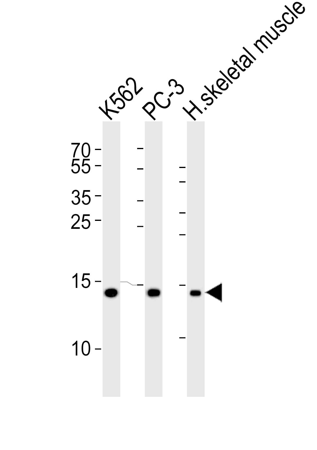 HIST1H2BM Antibody (RB49960)