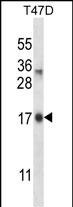 IGF2-AS Antibody (RB34180)