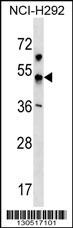 KCNJ18 Antibody (RB30517)