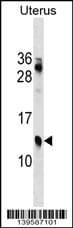 KLKP1 Antibody (RB39587)