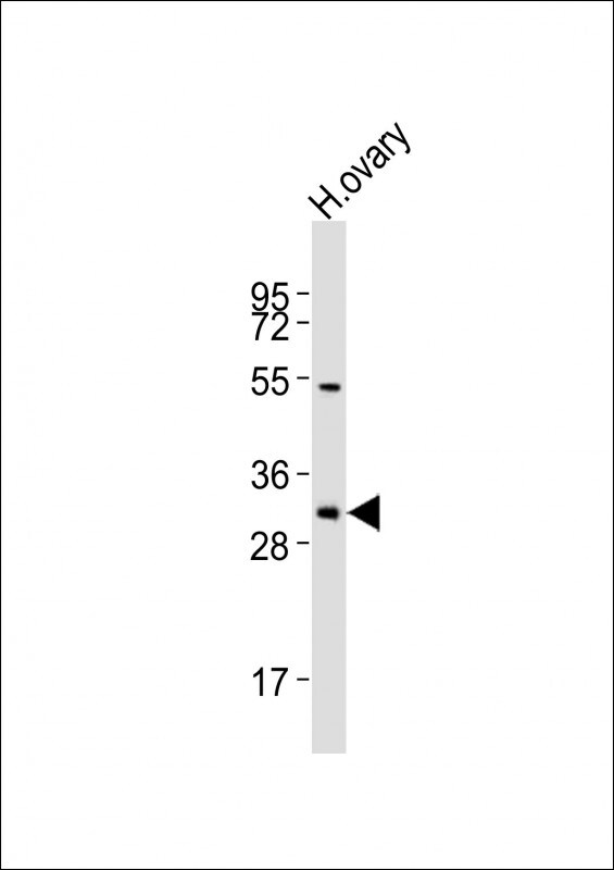 NBPF12 Antibody (RB53822)