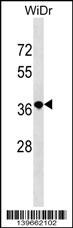 RRN3P2 Antibody (RB39662)