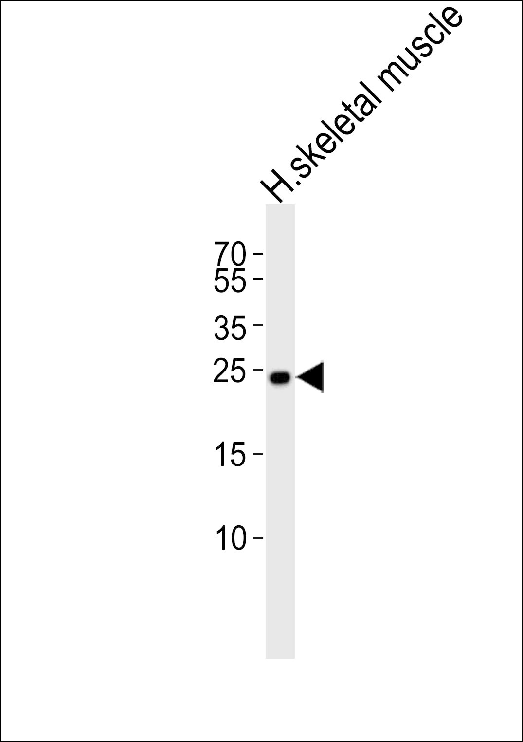 TMEM239 Antibody (RB49937)