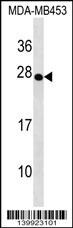TRDC Antibody (RB39923)