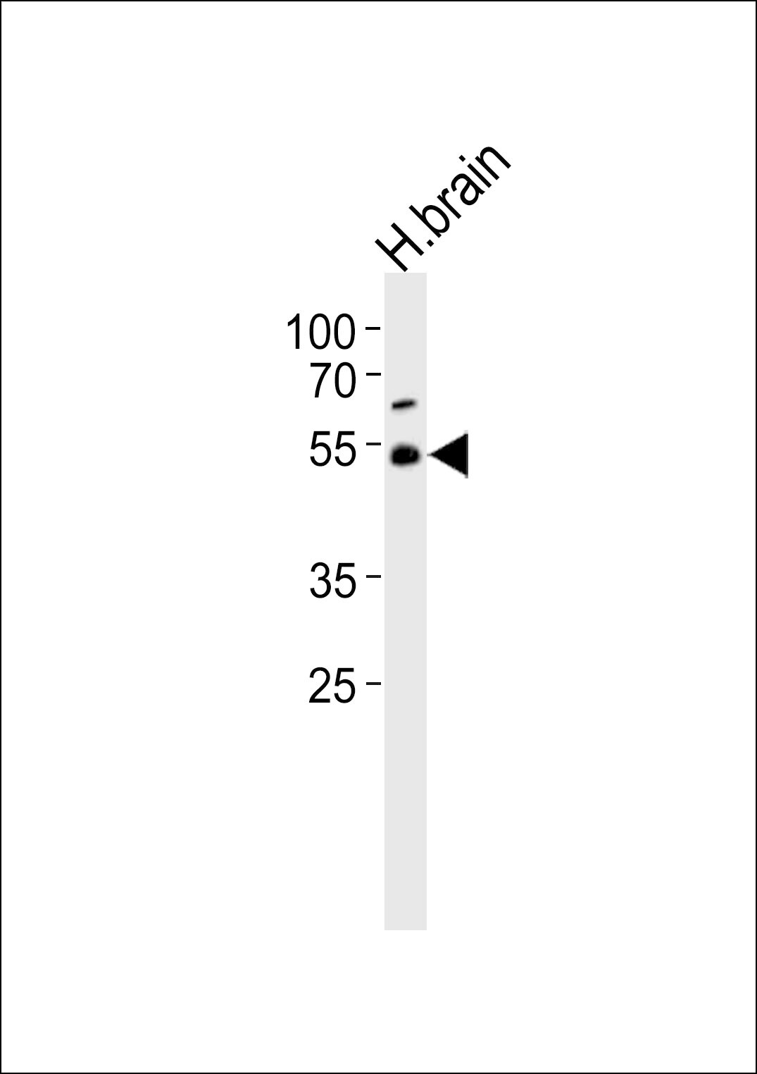 TRIM43B Antibody (RB49774)