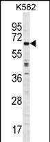 TRIM75 Antibody (RB31001)