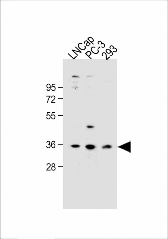 OR6C3 Antibody (RB49992)