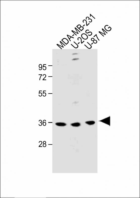 OR6C3 Antibody (RB49992)