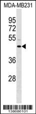 Annexin A8/ANXA8 Antibody (RB38686)