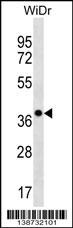 CLCA3 Antibody (RB38732)
