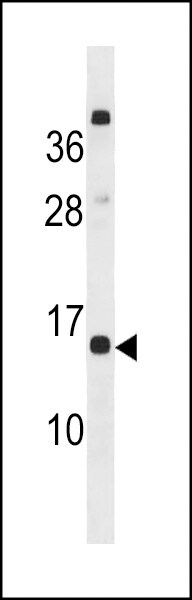 CLEC19A Antibody (RB42927)
