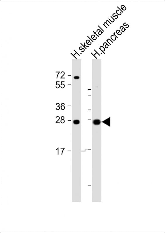 ELA2B Antibody (RB53040)