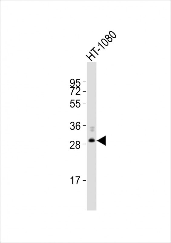 FBXO45 Antibody (RB53750)