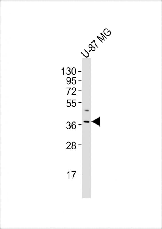 OR4K17 Antibody (RB50072)