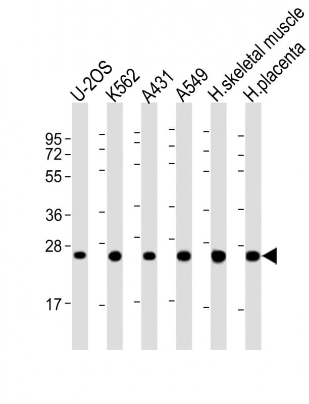 UQCRFS1 Antibody (RB53862)