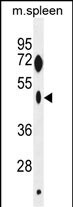 ZNF385C Antibody (RB29285)