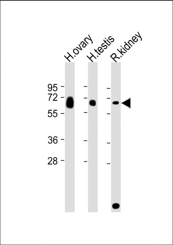 GGT3P Antibody (RB55246)