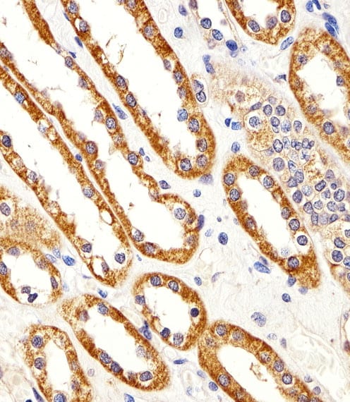 CYS1 Antibody (RB49884)