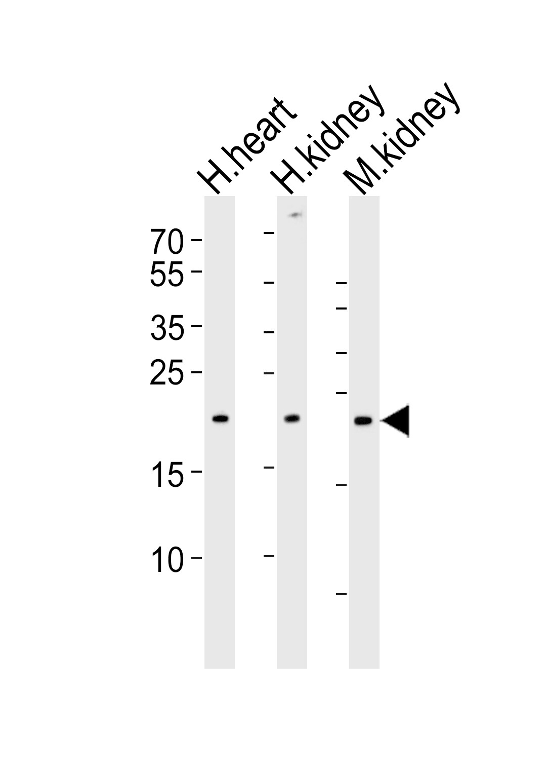 CYS1 Antibody (RB49884)