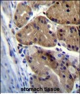 DCDC1 Antibody (RB29404)