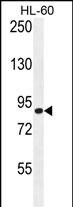DCDC1 Antibody (RB29404)