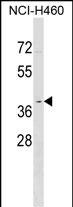 OR2Y1 Antibody (RB37957)
