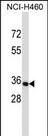 OR5BF1 Antibody (RB33817)