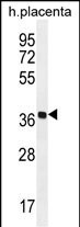 OR5AS1 Antibody (RB29991)