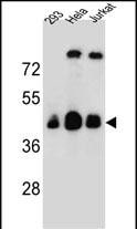 OR4C13 Antibody (RB29577)