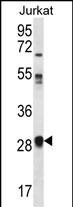 OR11L1 Antibody (RB31262)