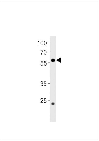 ccdc149b Antibody (RB44626)