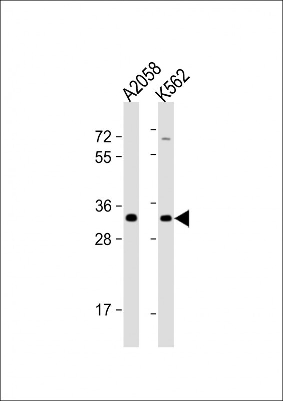 OR8J3 Antibody (RB30427)