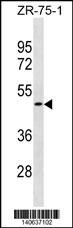 OR1S2 Antibody (RB40637)