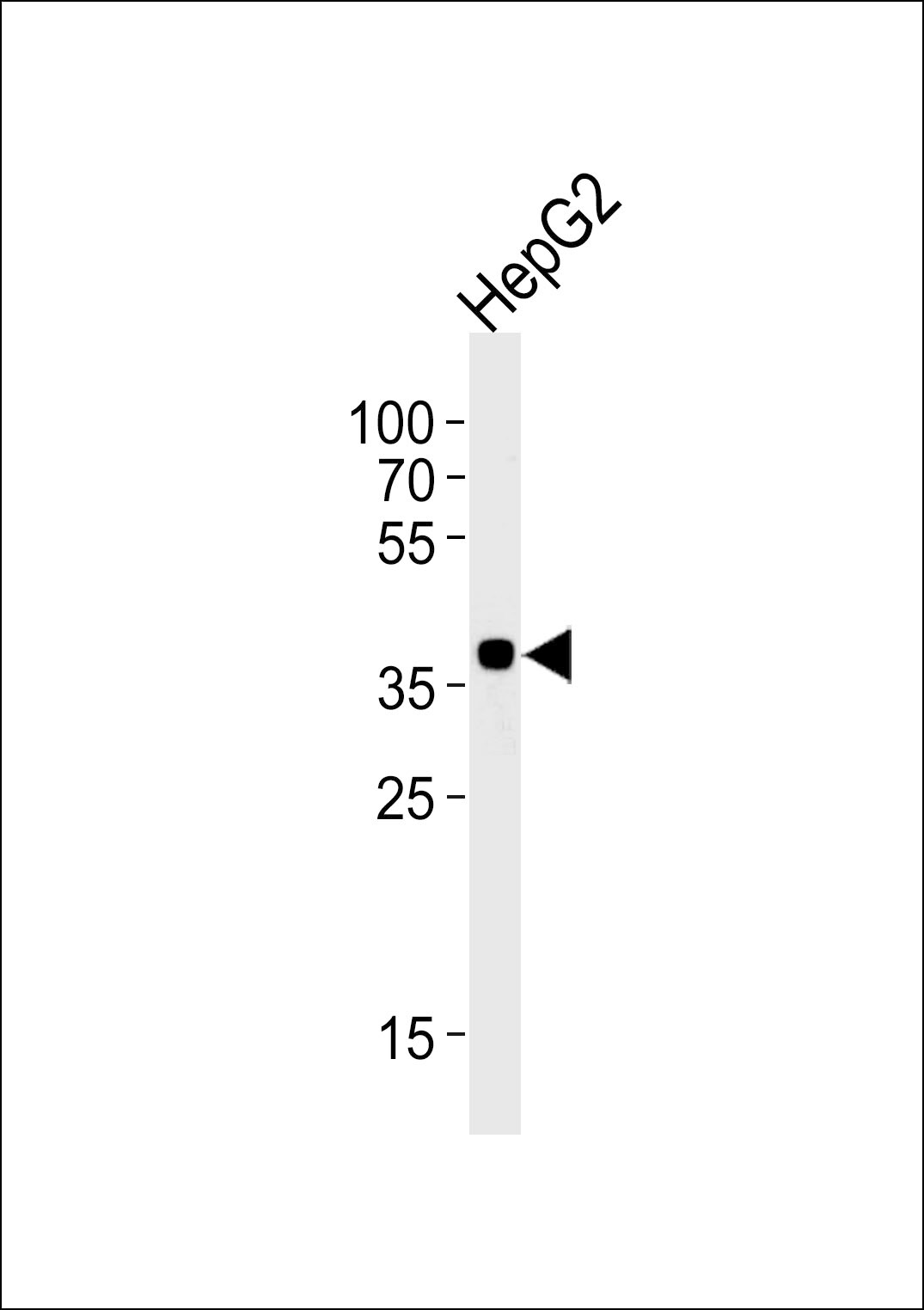 OR2M7 Antibody (RB29807)
