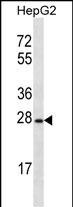 OR8B12 Antibody (RB34906)