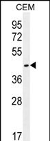 OR8H2 Antibody (RB29997)