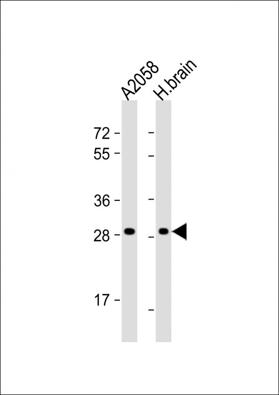 OR4F17 Antibody (RB28824)