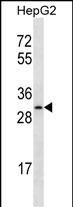 OR4C12 Antibody (RB34901)