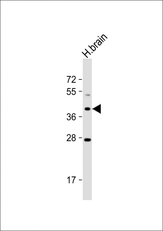 OR5M8 Antibody (RB33982)