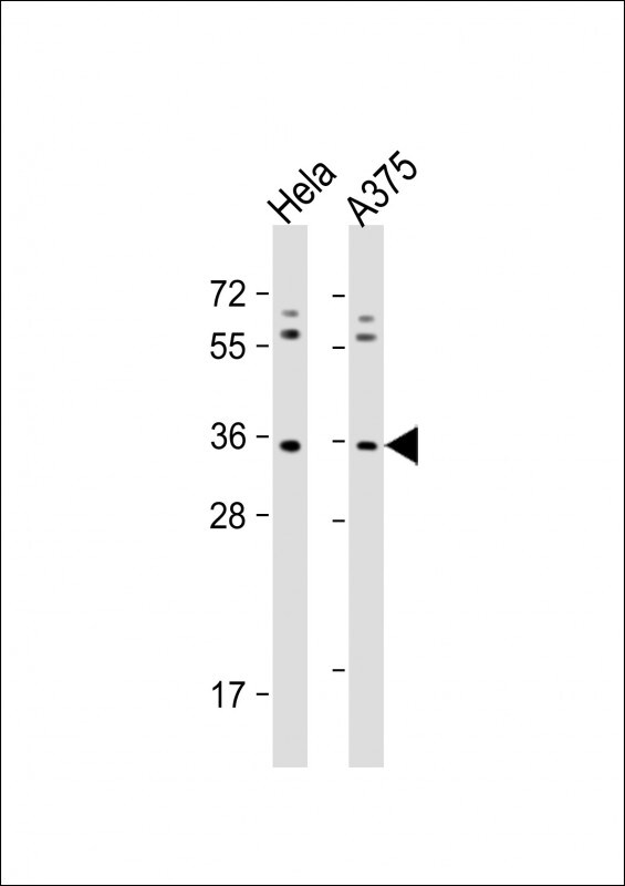 OR5AK2 Antibody (RB39790)