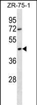 OR2T6 Antibody (RB29993)