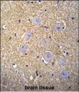 OR2T3 Antibody (RB29949)