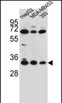 OR2T3 Antibody (RB29949)