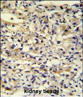 C1orf186 Antibody (RB27426)